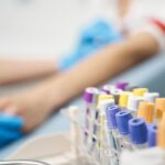 Badania diagnostyczne dla amatorów: które parametry krwi warto kontrolować