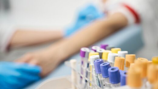 Badania diagnostyczne dla amatorów: które parametry krwi warto kontrolować